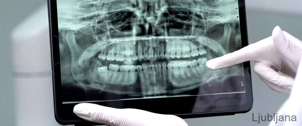 3 najboljše dentalne radiologije v Ljubljani